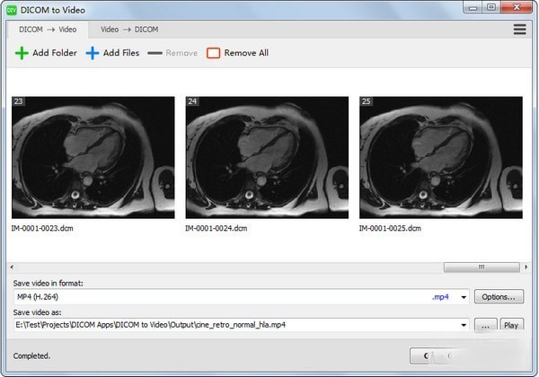 DICOM to Video(DICOM转视频工具)